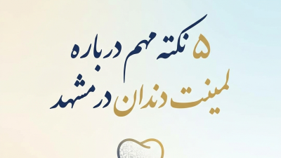 5 نکته مهم درباره لمینت دندان در مشهد