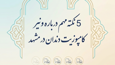 5 نکته مهم درباره ونیر کامپوزیت دندان در مشهد