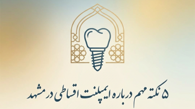 5 نکته مهم درباره ایمپلنت اقساطی در مشهد
